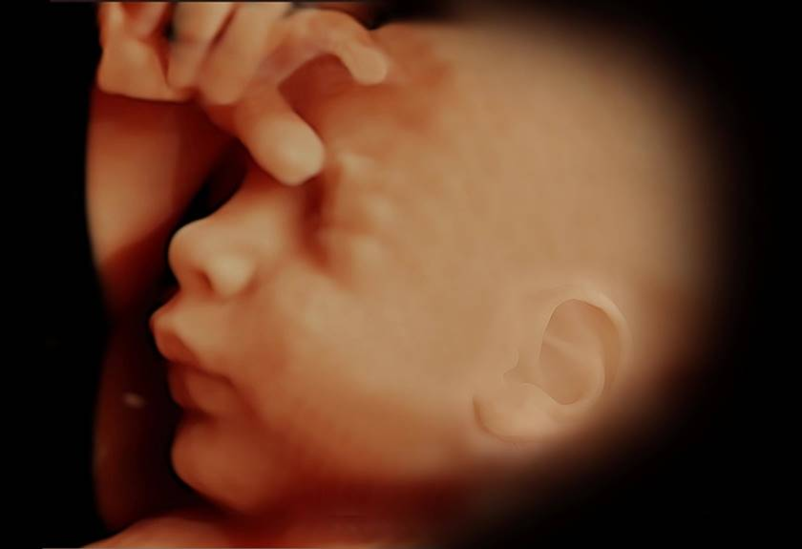 Bebektivite | Ayrıntılı Ultrason Nedir?