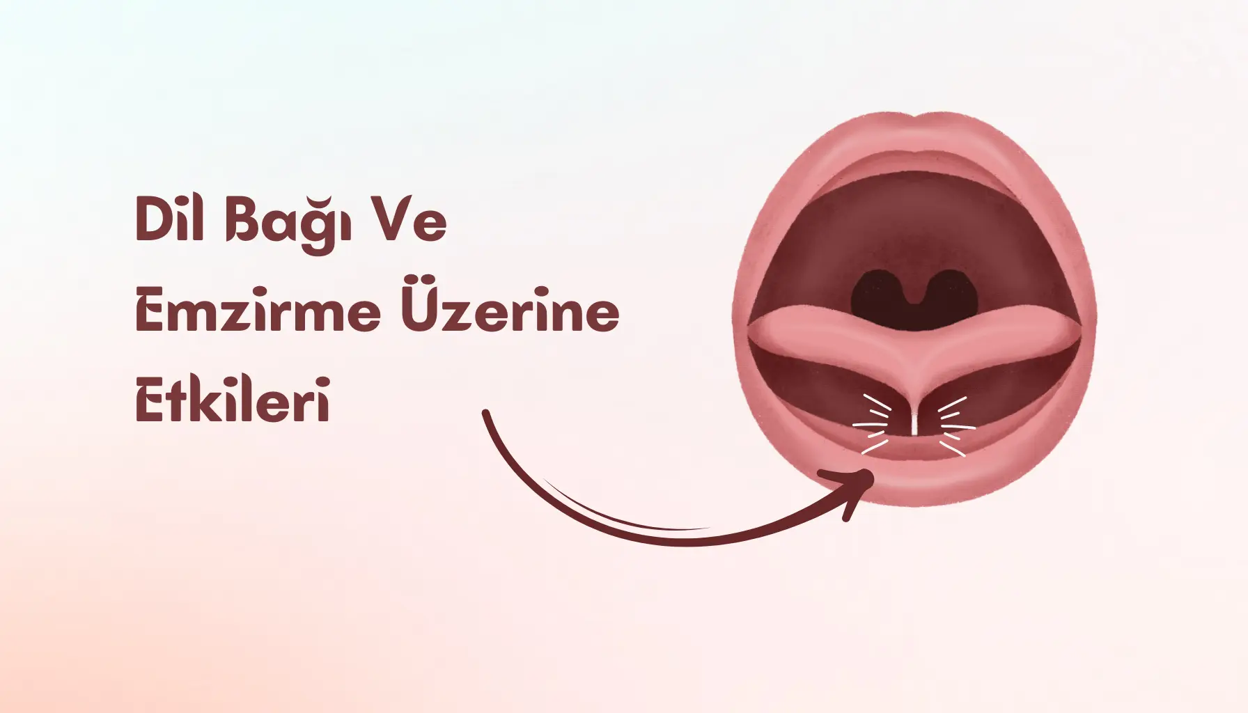 Bebektivite | Ankiloglossi Nedir? Bebeklerde Emzirme Üzerindeki Etkileri